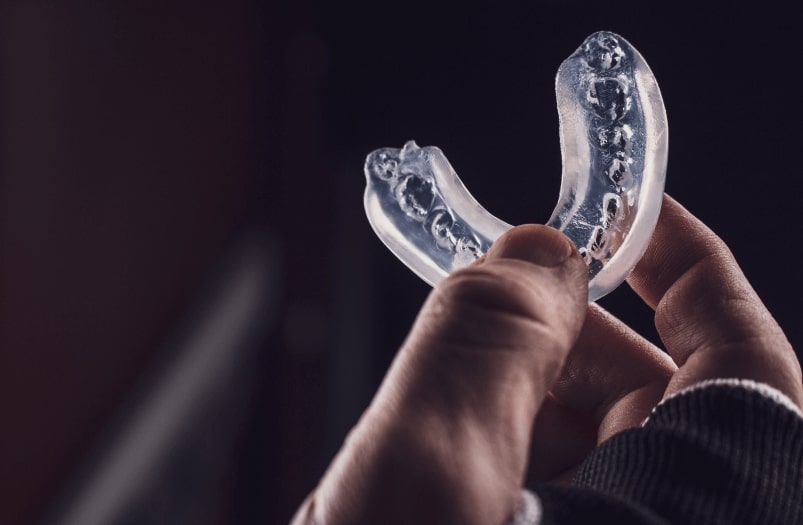 mouthguards-for-teeth