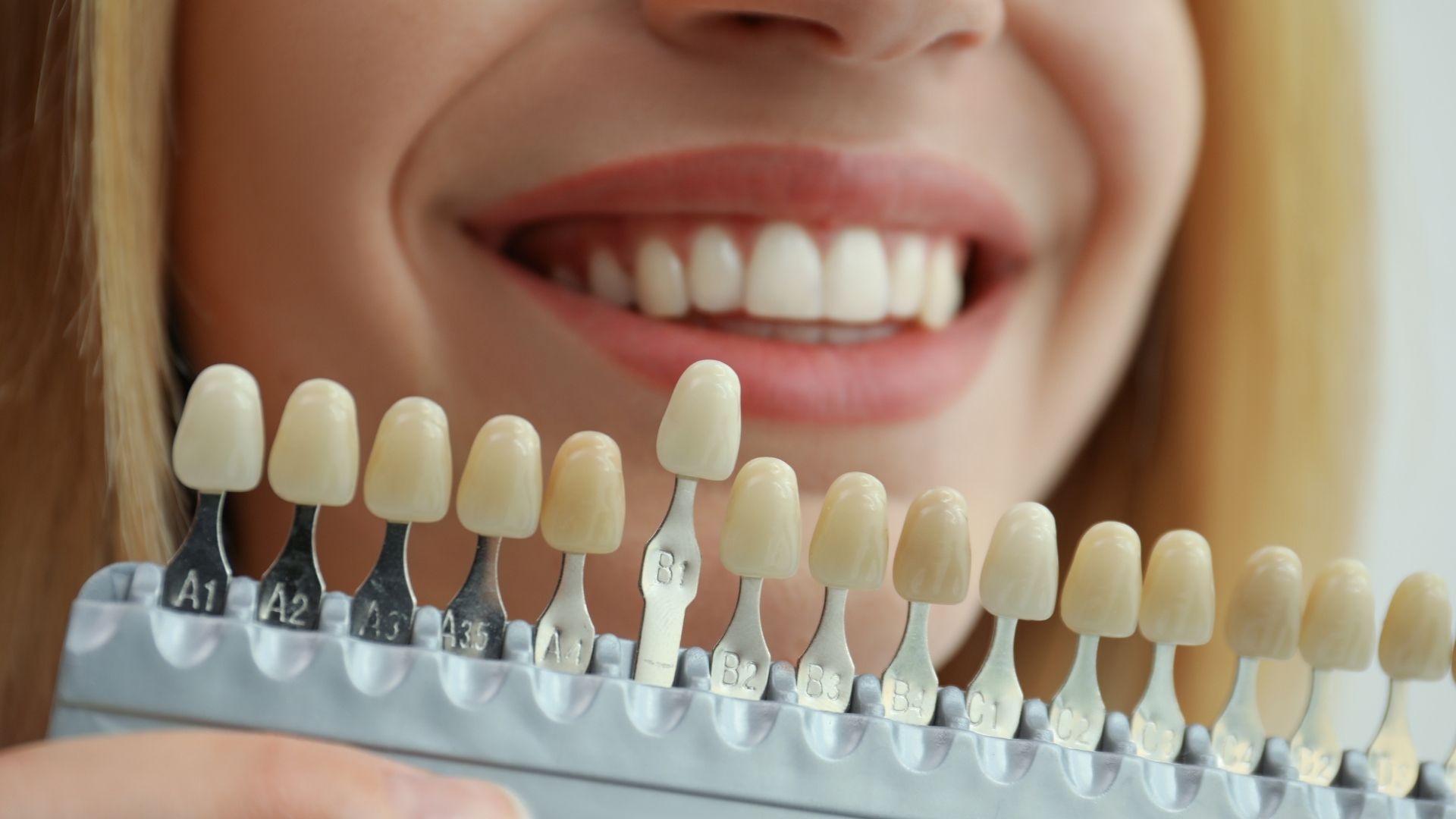 Cosmetic Dentistry in Bhubaneswar