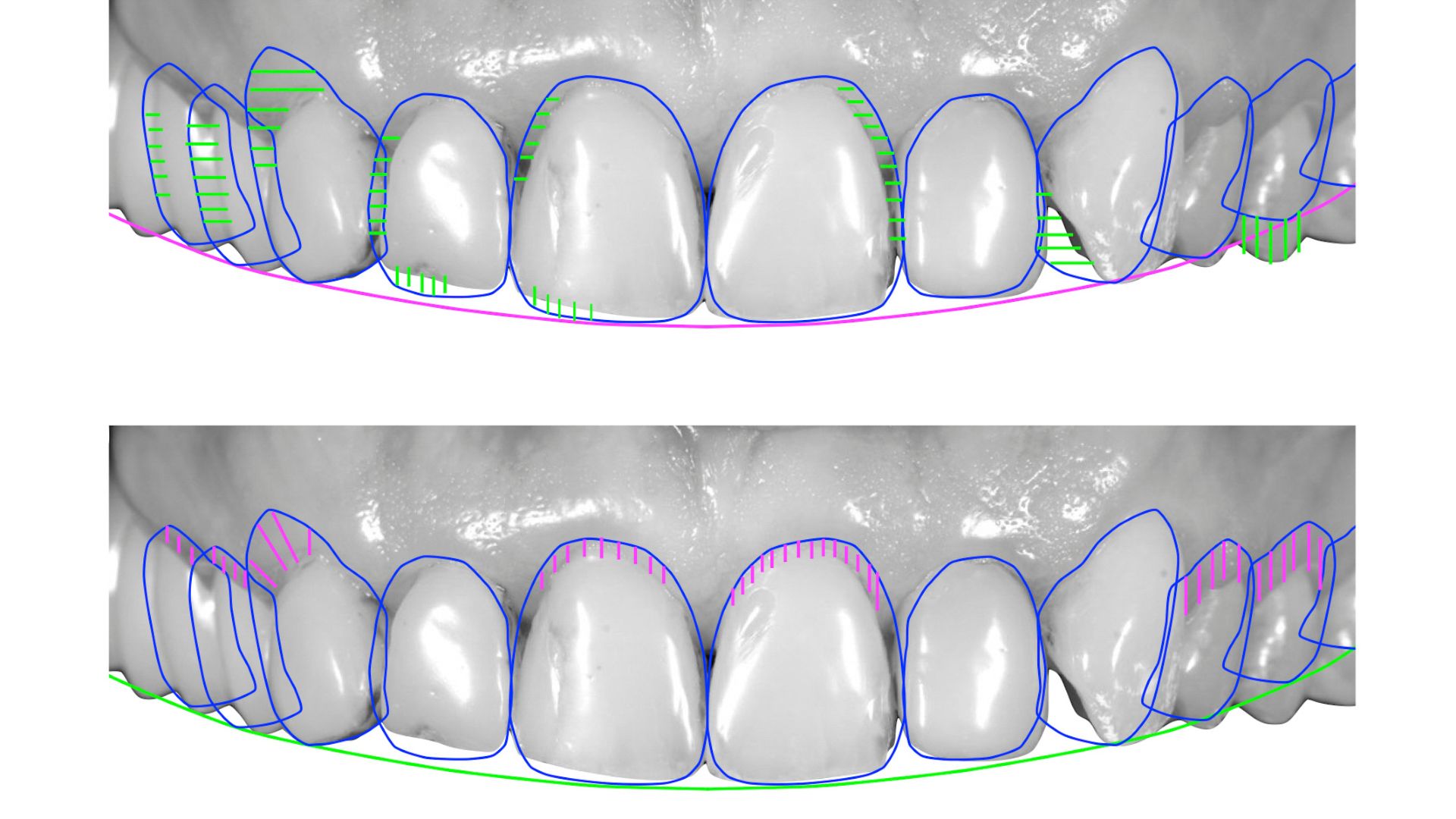 Digital Smile Design