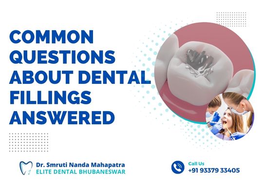 Common Questions About Dental Fillings Answered