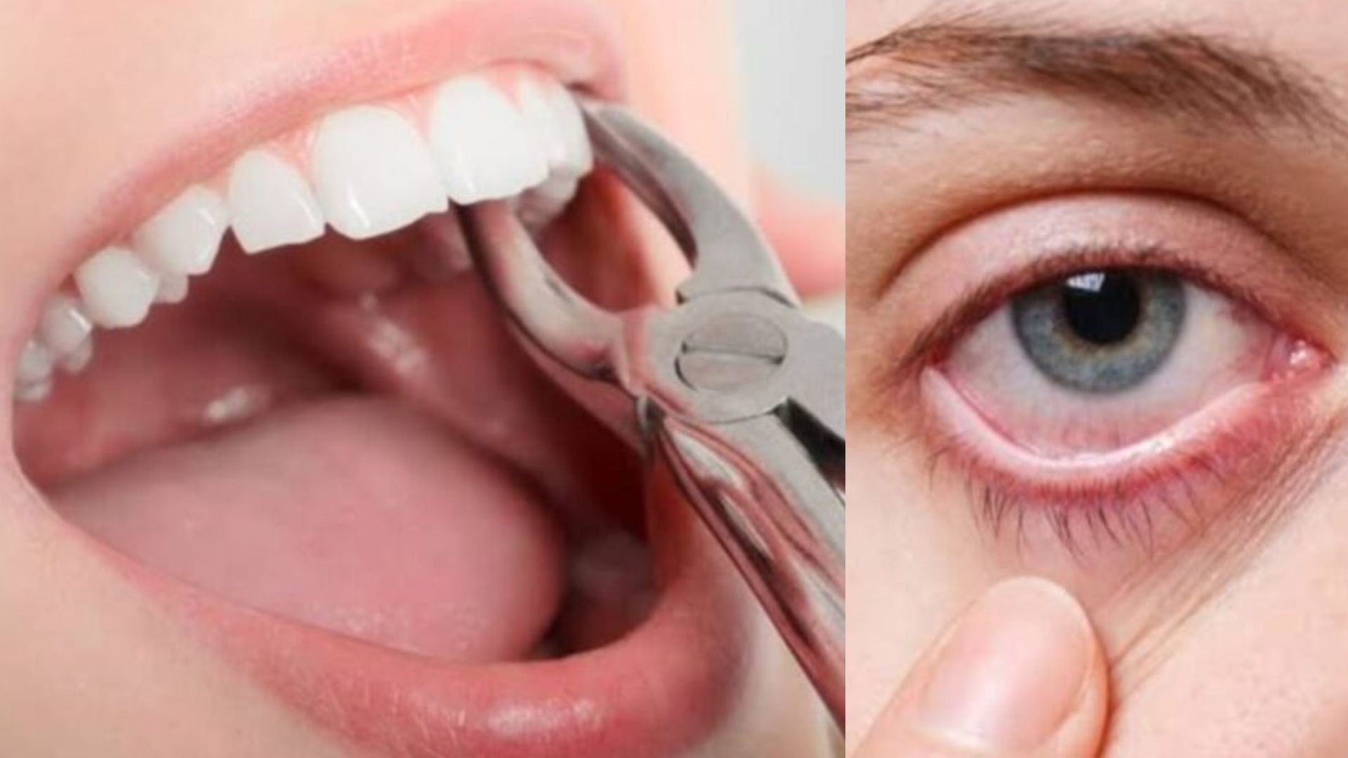 Removing a Tooth Affects Your Eyesight