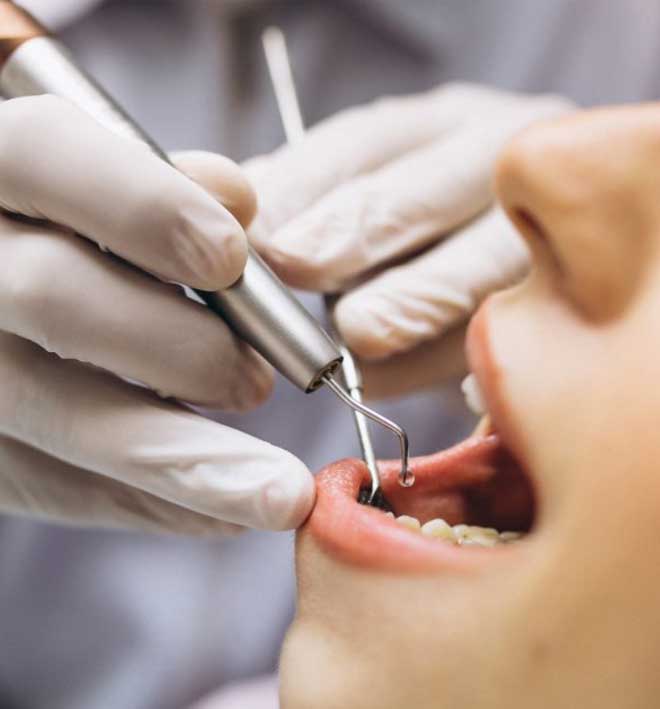 3 Ways To Have More Appealing cost of composite fillings